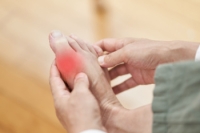 Gout and Its Lasting Impact on the Feet